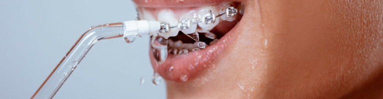 Рейтинг ирригаторов для гигиенической очистки полости рта